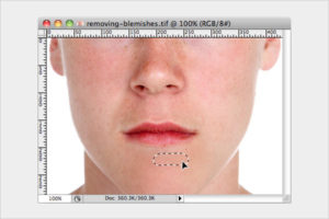 3-removing-blemishes-in-photoshop